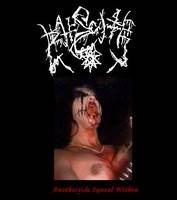 Anotheside Squeal Within